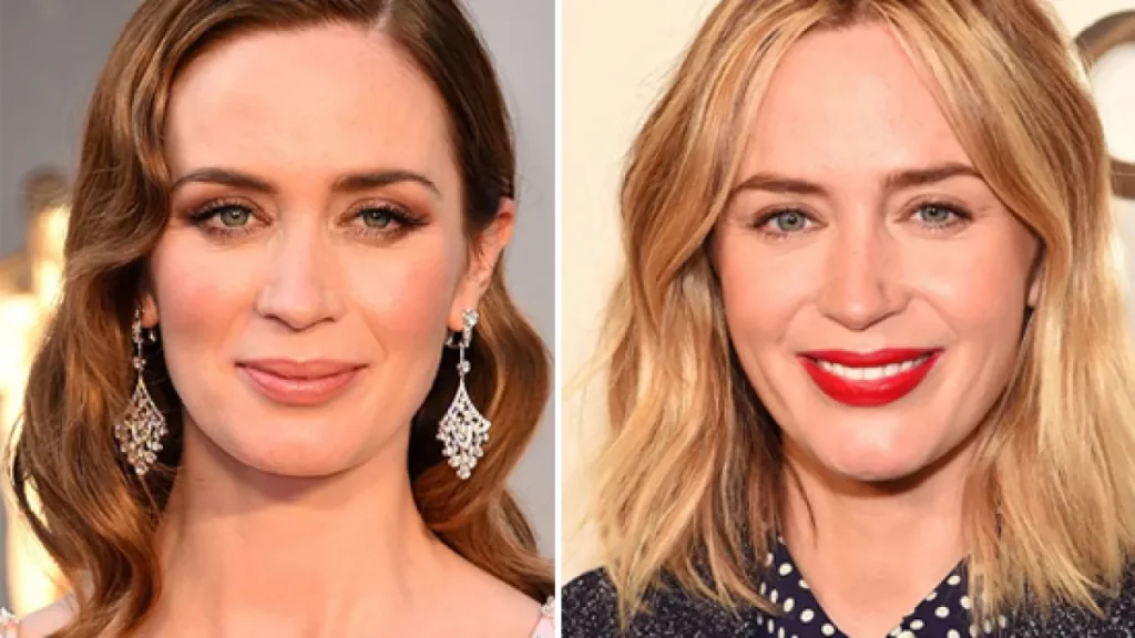 Emily Blunt's Before and After Surgery